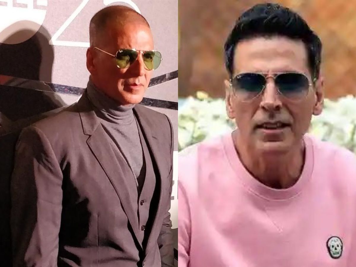 Bollywood Celebs Hair loss and Actors Hair Transplant photos before and  after pics TV Actors जिनके सिर से गायब हो गए थे बाल, ये हैं हेयर  ट्रासंप्लांट कराने वाले बॉलीवुड सेलेब्स |