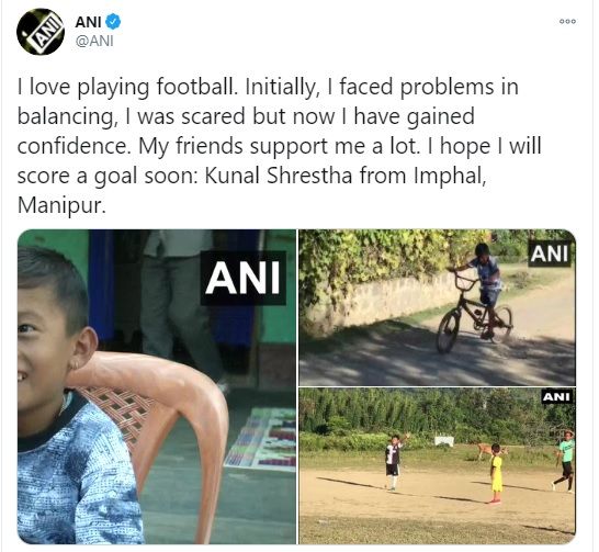 Imphan boy with one leg Kunal