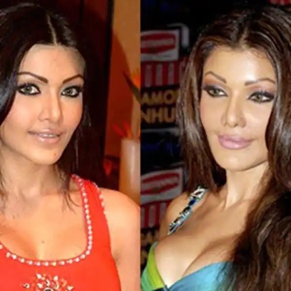 koena mitra nose cosmetic surgery