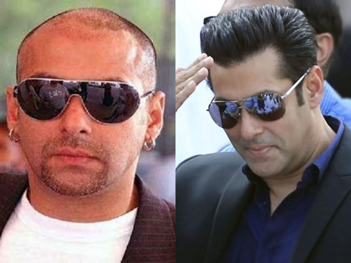 Salman Khan hair transplant