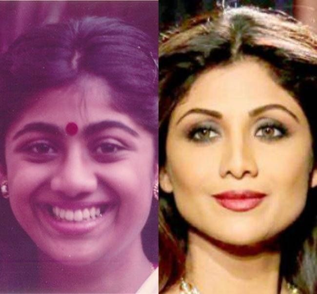 Shilpa Shetty nose surgery