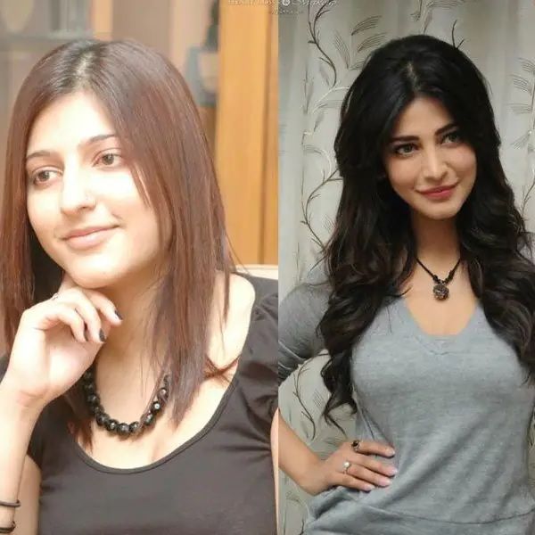 Shruti Haasan nose surgery