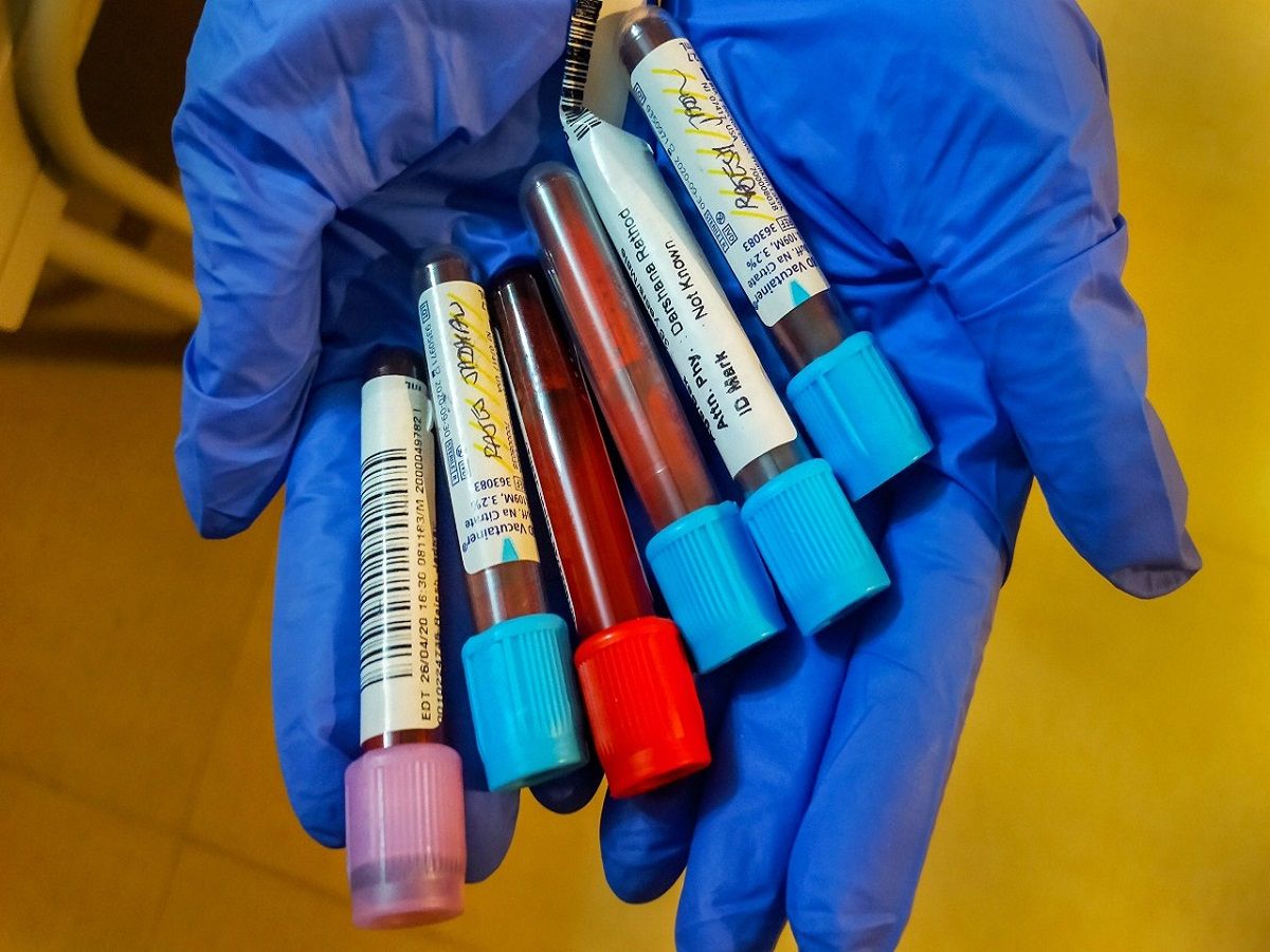 Coronavirus News Updates: कोरोना के ग्रोथ रेट में आ रही है कमी, शोध कार्य में भी आई तेजी