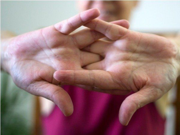 Side Effect habitual knuckle cracking