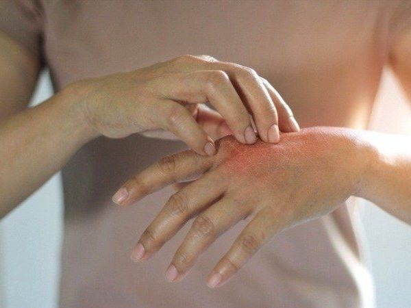 Five scents that mosquitoes really hate 