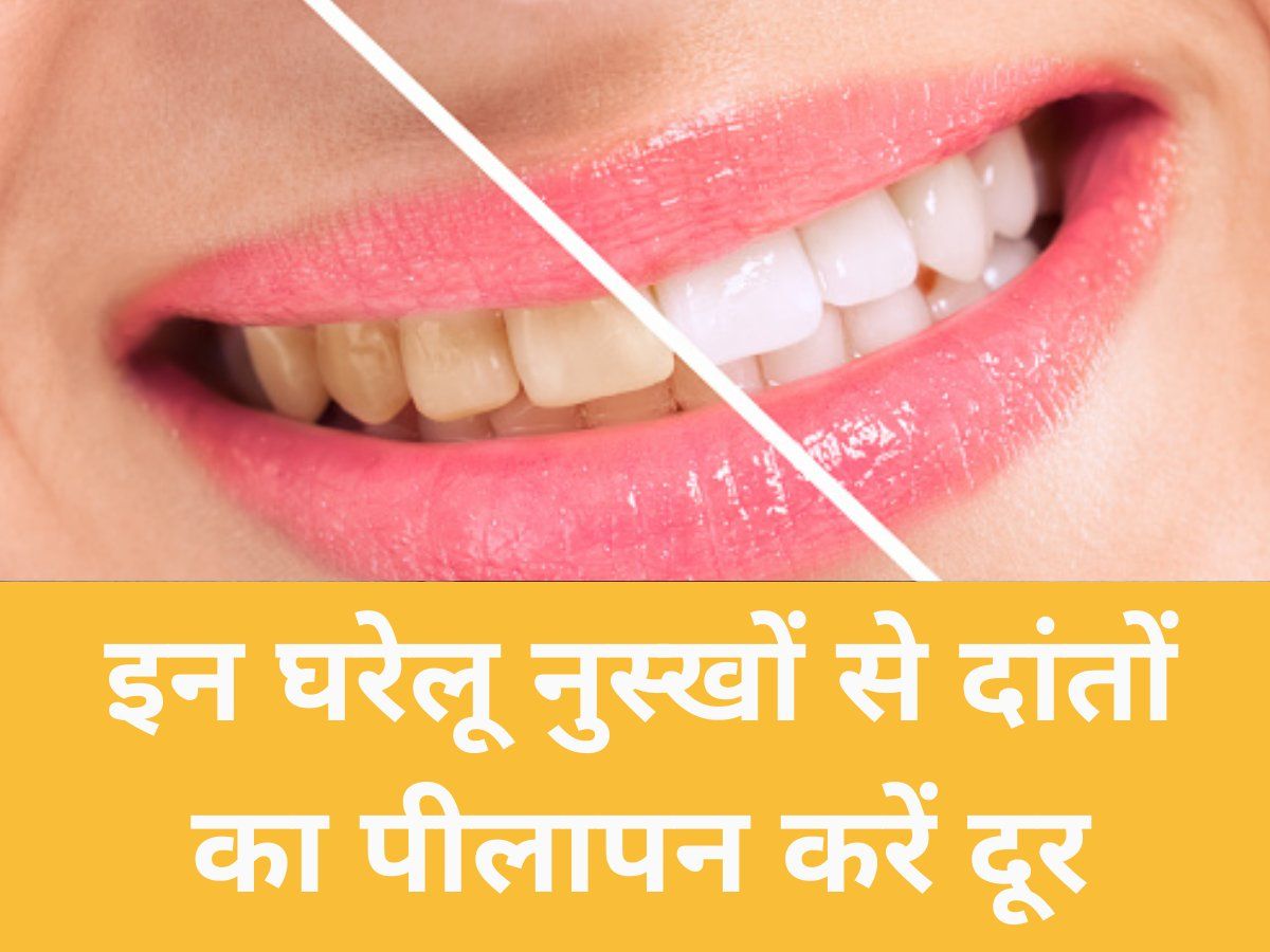 Remedies for Yellow teeth home remedies to remove yellow stains from
