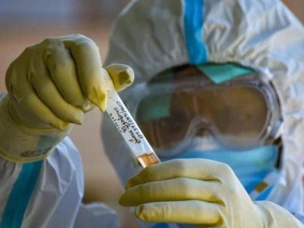 Kovid-19 in Taj city Agra