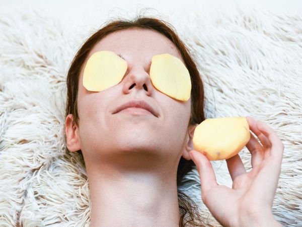 homemade remedies for dark circles