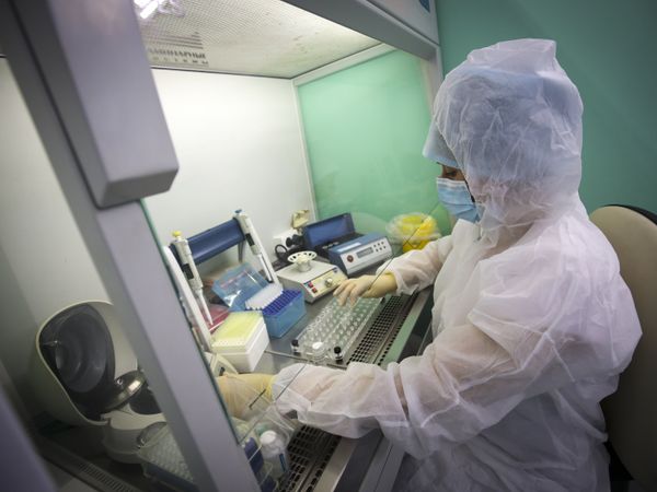 Coronavirus men may be more prone to this deadly virus says study