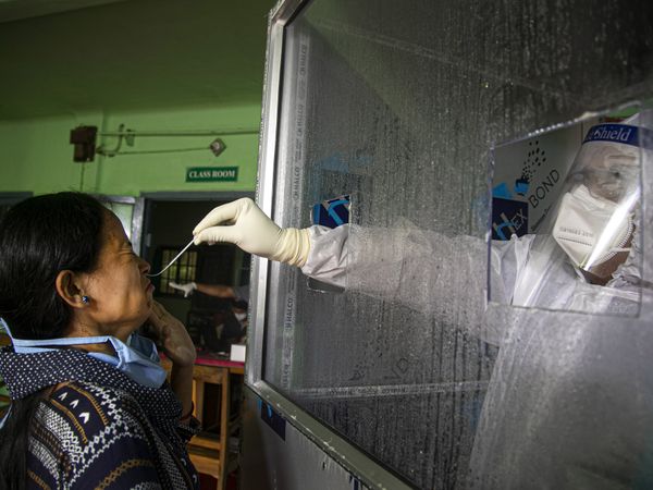 यूपी में प्रति 10 लाख की आबादी पर सबसे कम हैं संक्रमण के मामले, ब्राजील से भी बेहतर स्थिति में प्रदेश