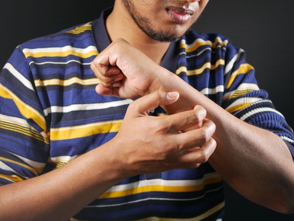 Are you allergic? So the risk of getting infected with Kovid may be reduced