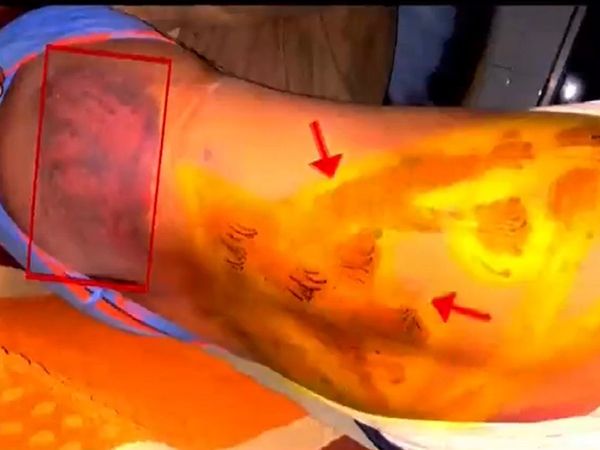 RTI activist Amra Ram