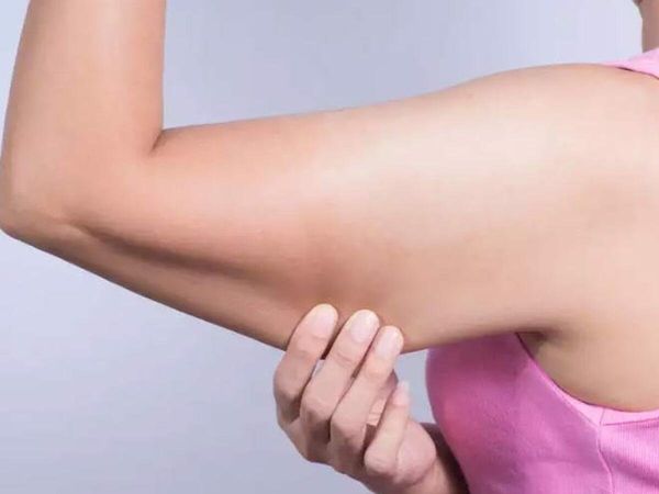 Arm Fat Weight Loss