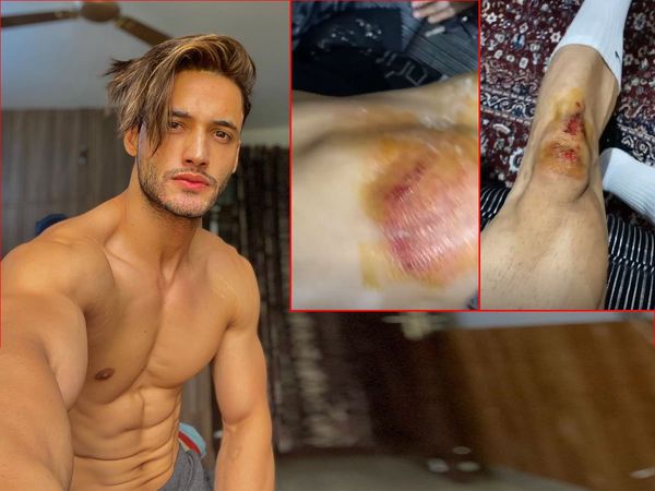 Asim Riaz attacked By gang Bigg Boss 13 Runner Up injured Video, 
