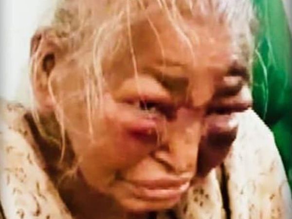 West Bengal : injured by beating 85-year-old woman demise, BJP targeted TMC