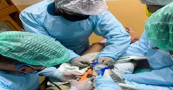 Tending news|  The person did such a thing that the private part got stuck in the lock, after 14 days the doctors cut it out.  Man’s Penis Gets Stuck in Padlock, Freed By Doctor After Two Weeks