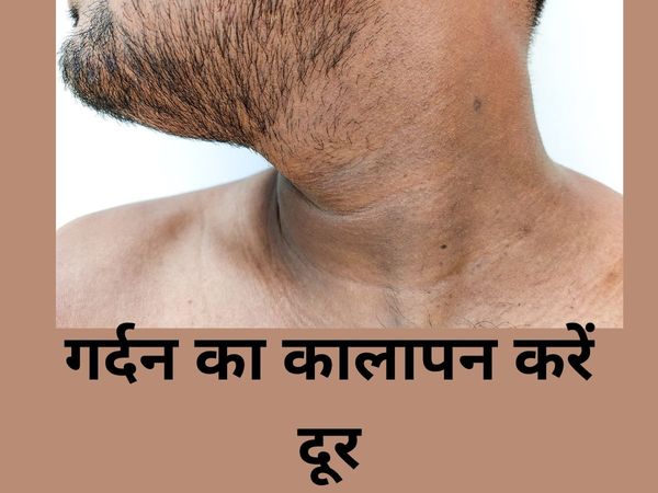Neck Blackness, Lifestyle, Beauty Tips, Home Remedies to Remove Blackness of Neck, 