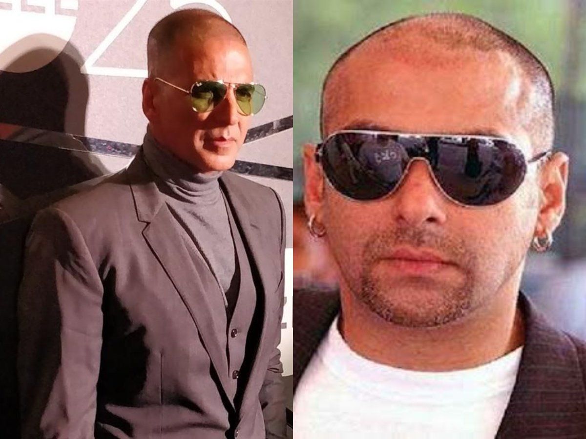 Who are the bald actors in Bollywood opted for hair transplant or wears  wig  Quora
