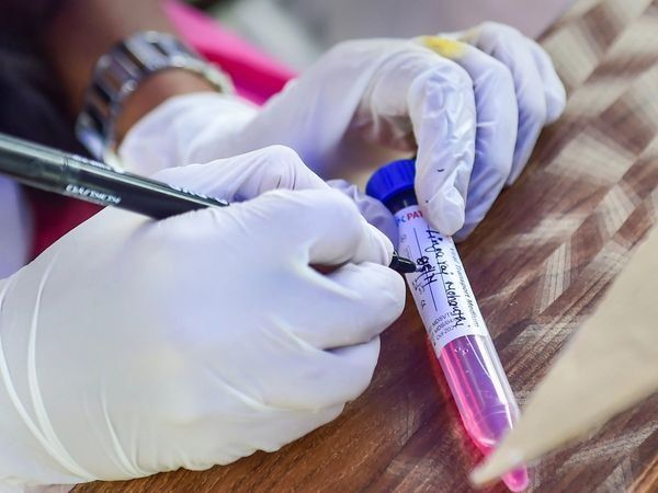 How much does RT-PCR test cost