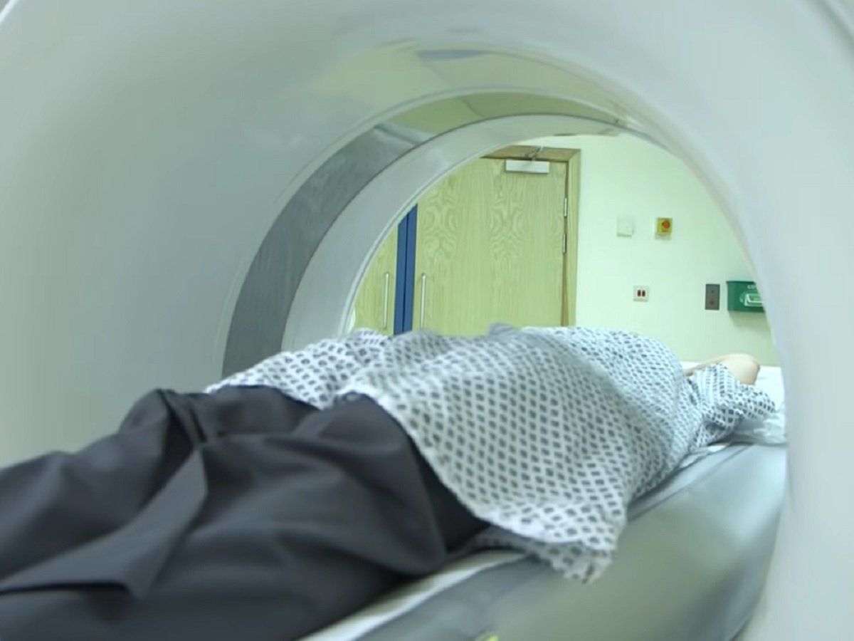 CT SCAN, Side Effects of CT Scan नुकसान पहुंचा सकता है सीटी स्कैन