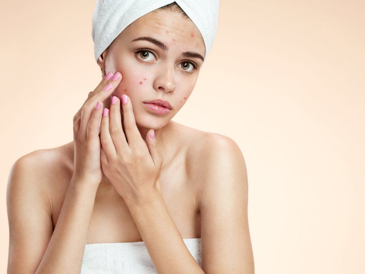 Causes of Pimples: सिर्फ यंग ऐज में ही नहीं किसी भी उम्र में हो सकते हैं पिंपल्स, जानें इसकी वजह