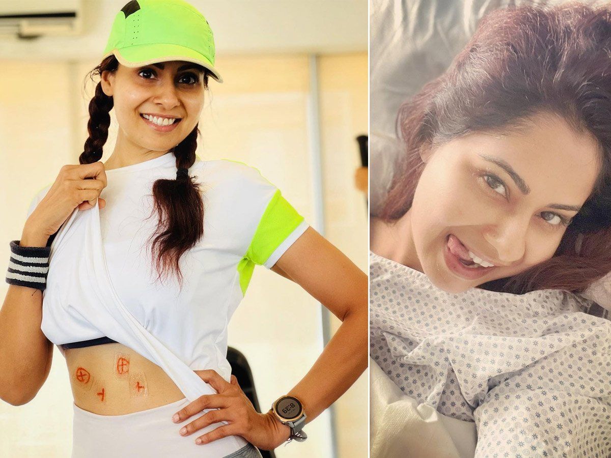 Tv Actress Chhavi Mittal Hussein Shares Photo After Radio Therapy Shows Marking On Her Body Says