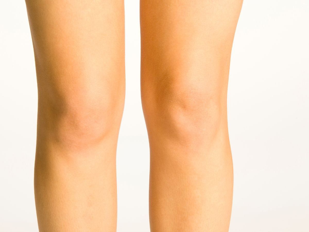 Skin Care Tips Know how to clean black knees and elbows home remedies