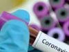 Suspected coronavirus patient admitted in Jaipur hospital