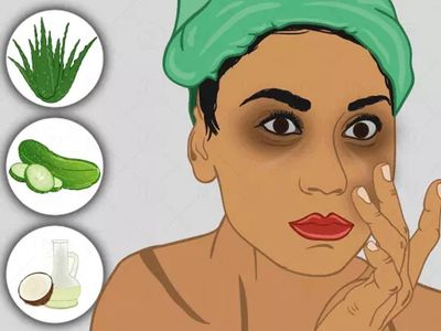 Dark Circles Tips Dark Circles Tips