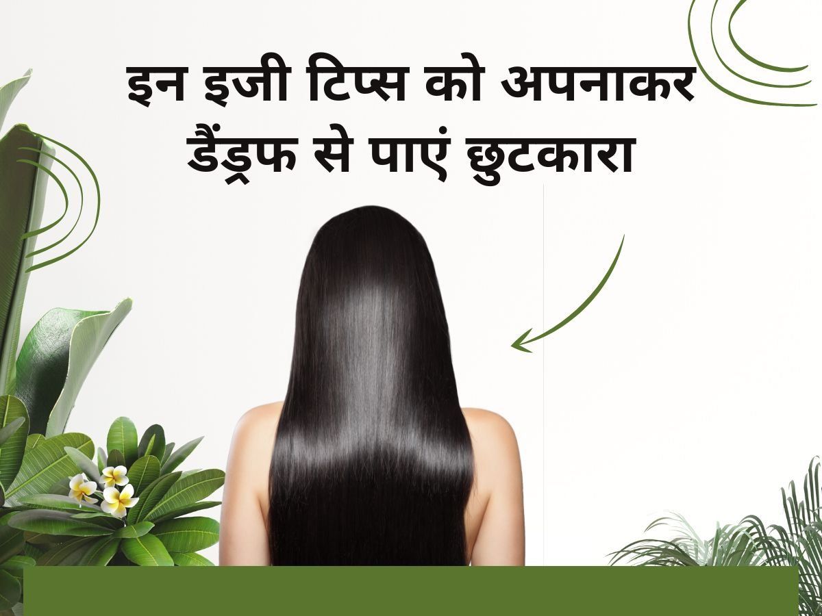 Hair Tips For Dandruff: सिर में खुजली और डैंड्रफ की समस्या से पाना चाहते हैं राहत, तो अपनाएं ये घरेलू टिप्स