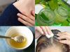 Get rid of dandruff at home