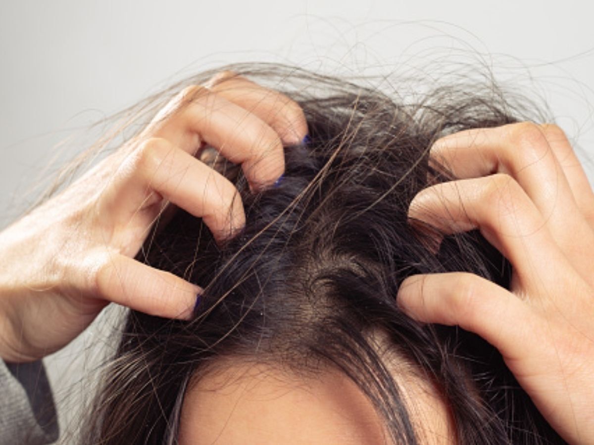Dry Scalp Remedies: ड्राई स्कैल्प की समस्या चुटकियों में होगी दूर, अपनाएं ये 4 घरेलू उपाय
