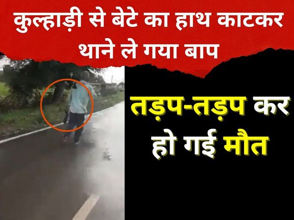 Damoh Father Cut Son Hand