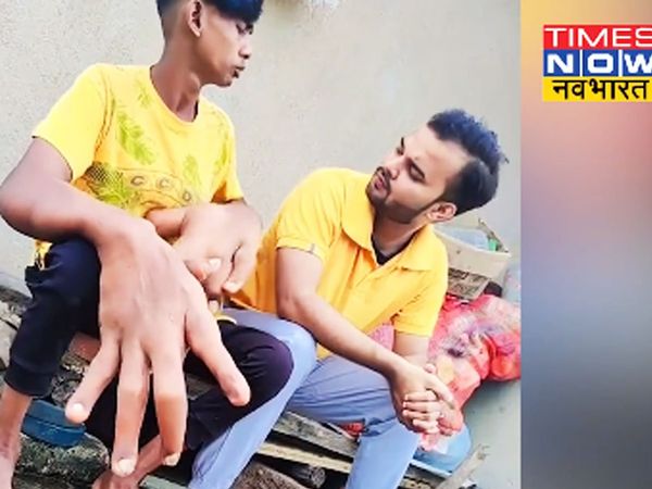 Viral Video Due to the hand of 2.5 KG we used to get taunts now shadow on social media