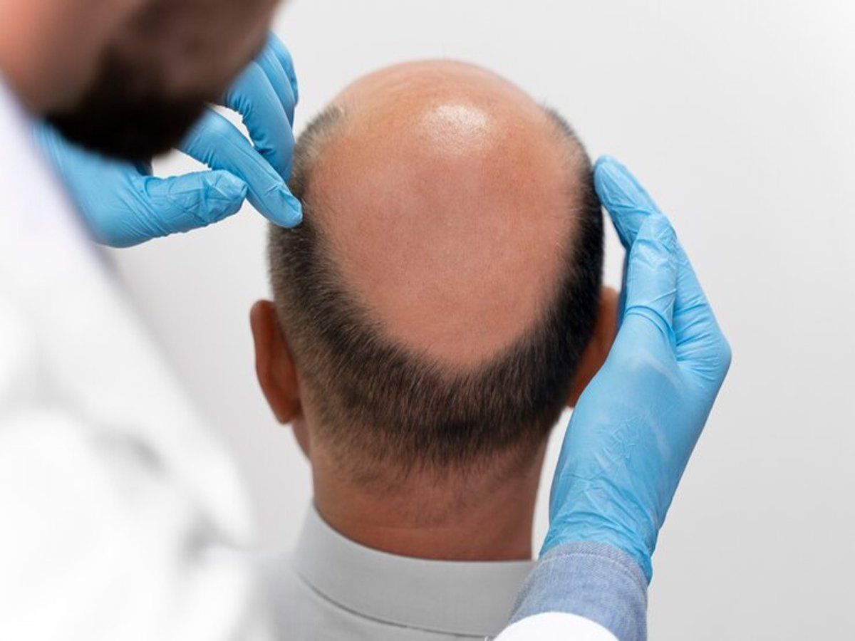 Men Hair Care Tips: हेयर लॉस की समस्या से हैं परेशान? जानें पुरुष कब और कैसे करें बालों की केयर, जानें टिप्स