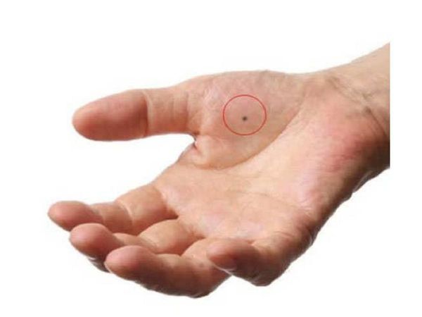 Meaning of mole on your palm