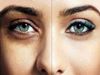 Home Remedies Tips For Dark Circles