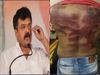 5 security personnel of Maharashtra Minister Jitendra Awhad arrested following the assault on an engineer