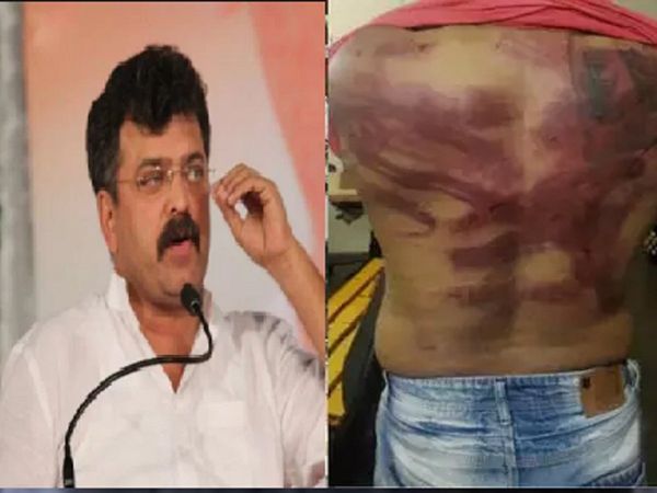 5 security personnel of Maharashtra Minister Jitendra Awhad arrested following the assault on an engineer