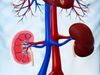 Kidney