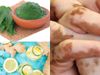 home remedies for leucoderma, सफेद दाग पर बेहद कारगर हैं ये घरेलू नुस्खे