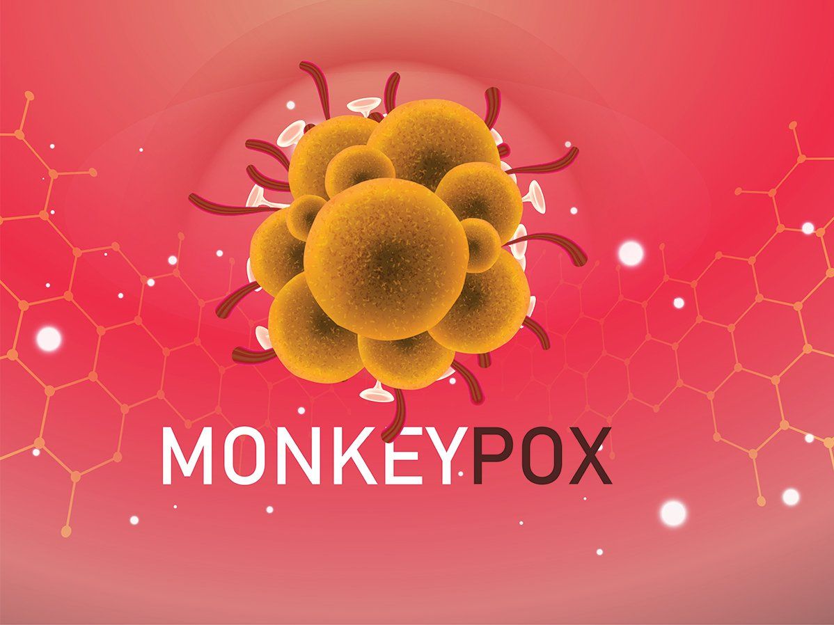 Monkeypox Alert: बढ़ रहा है मंकी पॉक्स संक्रमण का दायरा, उत्तर प्रदेश के अस्पतालों में अलर्ट, जानें क्या हैं लक्षण