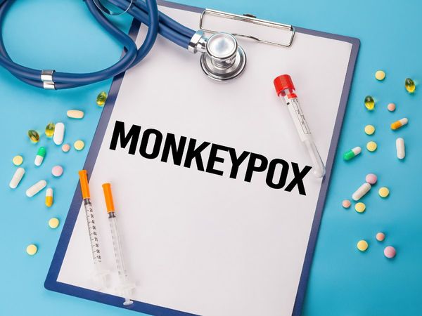  Monkeypox Virus
