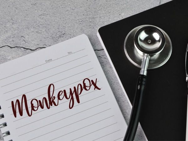 monkeypox virus, monkeypox virus infection, monkeypox virus treatment, monkeypox virus symptoms, monkeypox virus infection symptoms in hindi, monkeypox virus in hindi, what is monkeypox virus, what is monkeypox virus infection