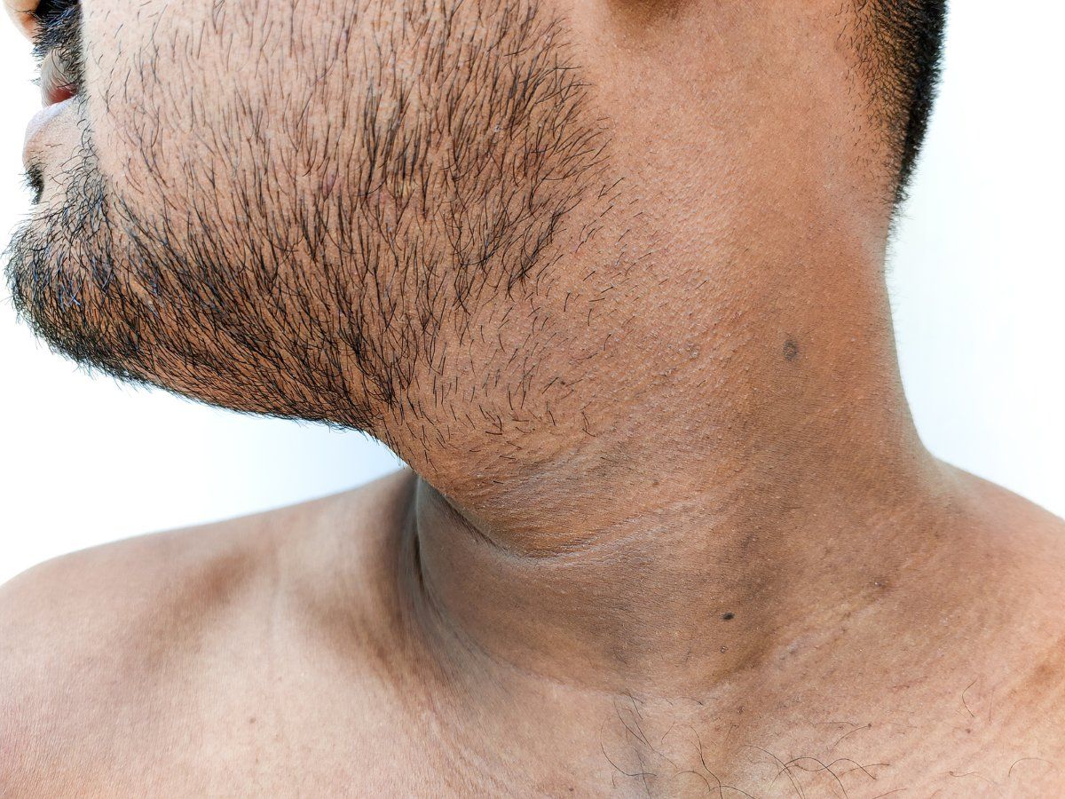 Homemade Pack For Neck Darkness: काली गर्दन से हैं परेशान? मिनटों में चमकाएंगे ये होममेड पैक