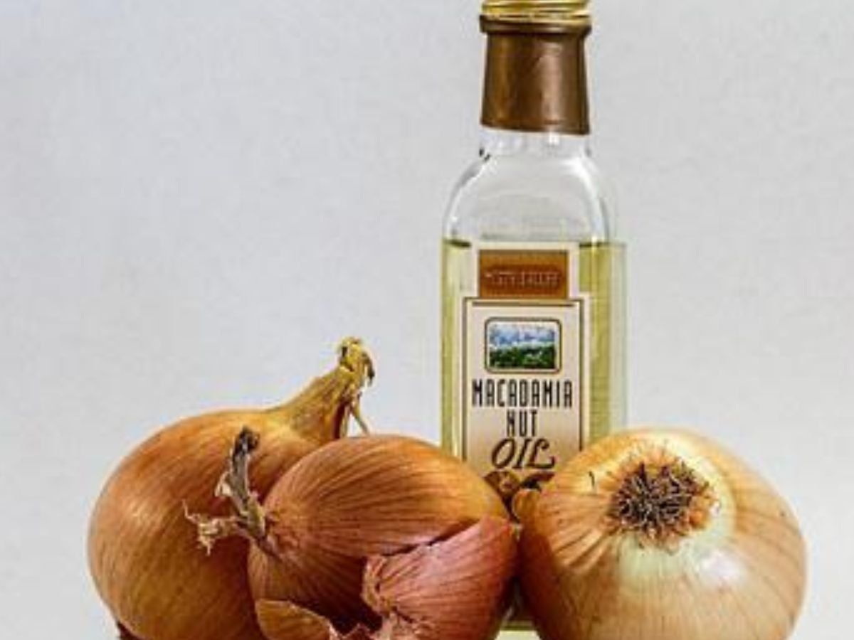 Onion oil for Hair : Benefits of applying onion oil on hair - गिरते-टूटते  बालों से हैं परेशान, तो आजमाएं प्याज का तेल, हफ्तेभर में मिलेगा फायदा