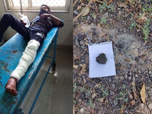 Delhi: Rape accused of minor girl arrested after encounter, illegal weapons also recovered