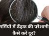 Remedies for Dandruff