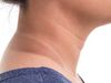 Remedies for Dark Neck