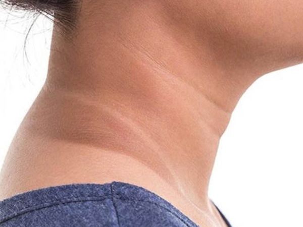 Remedies for Dark Neck